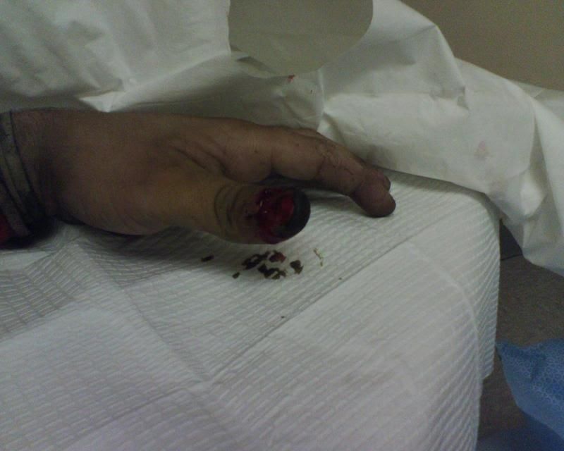 IMG00011.jpg